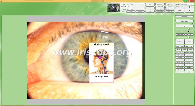 IRISCOPE DM881US per pc supporta window XP/7/8/10/11/Mac OS