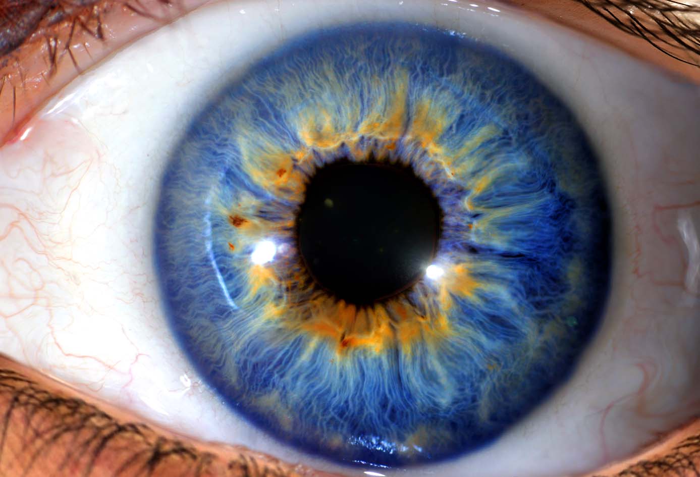 Osaka Iridology Branches in Manila: Histoire, Fonctionnement, Avantages and Application
