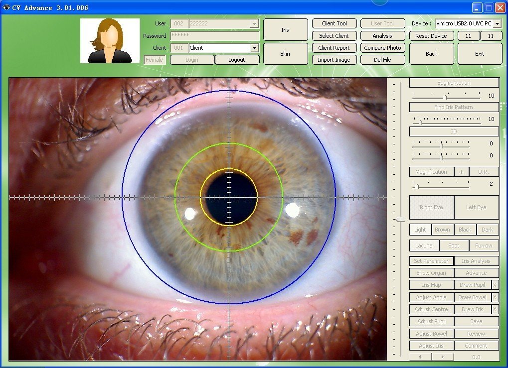 Iridoscopio Amazon – Un outil de diagnostic oculaire efficace pour tous